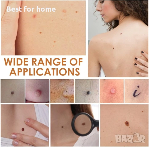 Електрически комплект за премахване на бенки с акумулаторна писалка с 9 нива, снимка 6 - Други - 53816471