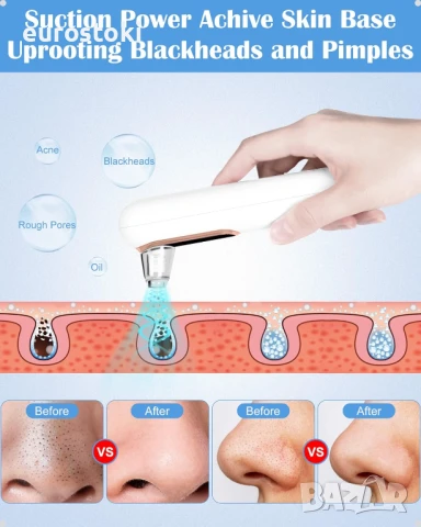 Yccu Вакуумно средство за премахване на черни точки, за грижа за лицето, снимка 6 - Други - 51230942