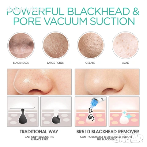 Вакуумен уред за премахване на черни точки и почистване на пори с LCD дисплей, снимка 3 - Други - 53239969