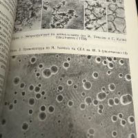 Микоплазмени инфекции у човека -В.Мандулов, снимка 6 - Специализирана литература - 45322000