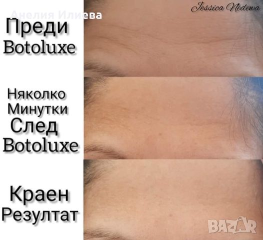 Крем Botoluxe, снимка 1 - Козметика за лице - 45607849