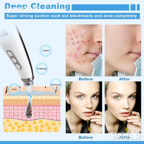 Vacuum blackhead remover премахване на черни точки, USB акумулаторен екстрактор на пъпки Tibobo, снимка 2 - Други - 46673685