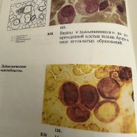 Болезни крови у детей -Атлас, снимка 11 - Специализирана литература - 45300488