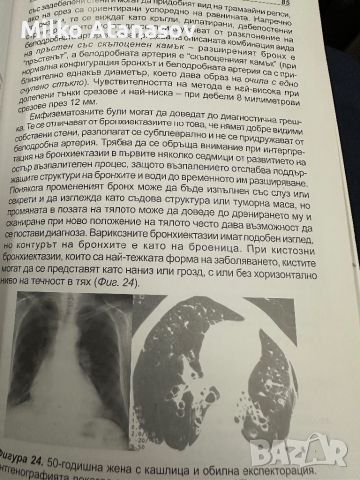 ХОББ-Ако има такава болест, снимка 7 - Специализирана литература - 45389342