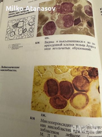 Болезни крови у детей -Атлас, снимка 11 - Специализирана литература - 45300488