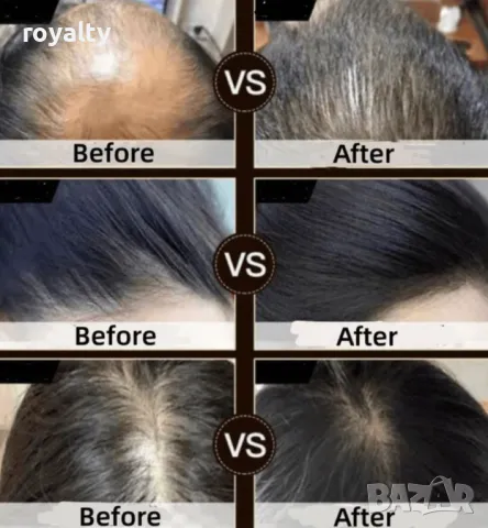 Ревитализиращ сапун за коса и кожа с екстракт от полигон, снимка 5 - Продукти за коса - 50131987