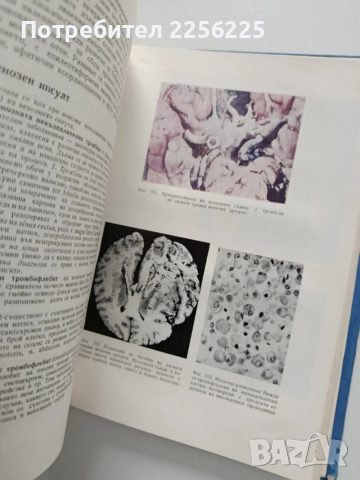 Неврология, снимка 5 - Специализирана литература - 54031163