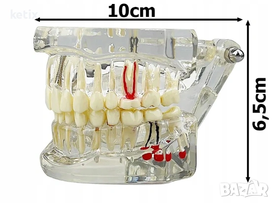 Дентален модел с реставрация, снимка 7 - Стоматология - 53018772