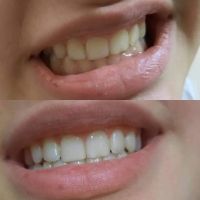 Паста за избелване на зъбите Extra white pro, снимка 5 - Други - 45170763