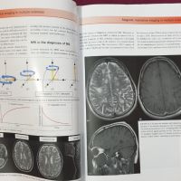 Множествена склероза - визуален справочник / Multiple Sclerosis - Visual Guide for Clinicians, снимка 6 - Специализирана литература - 45667994