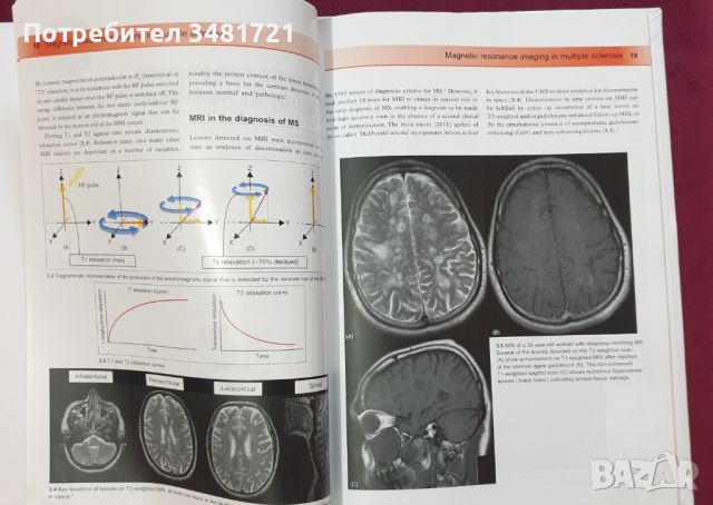 Множествена склероза - визуален справочник / Multiple Sclerosis - Visual Guide for Clinicians, снимка 6 - Специализирана литература - 45667994