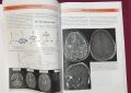 Множествена склероза - визуален справочник / Multiple Sclerosis - Visual Guide for Clinicians, снимка 6