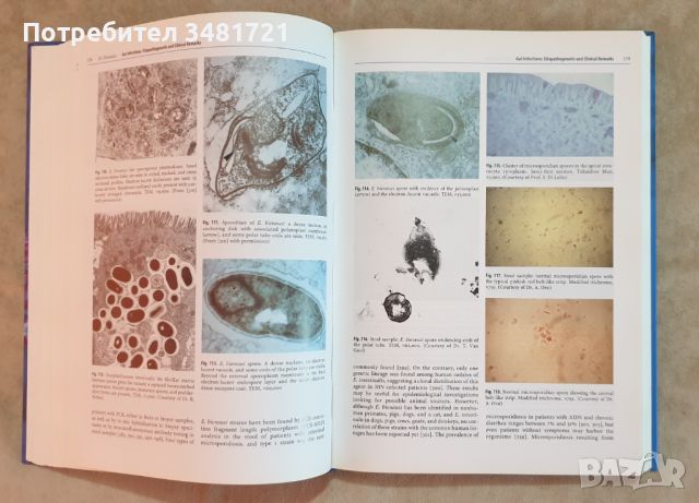 Учебник-атлас по чревни инфекции при СПИН / Textbook-Atlas of Intestinal Infections in AIDS, снимка 4 - Специализирана литература - 46497175