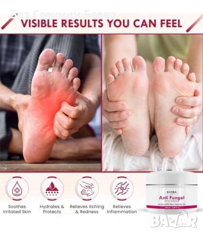 Нов Крем против гъбички с урея и лавандула за крака и нокти Лечение, снимка 4 - Козметика за тяло - 51136081