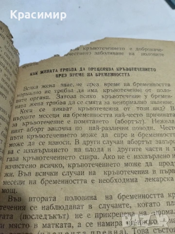 Течение и кръвотечение у жената., снимка 9 - Антикварни и старинни предмети - 51153241