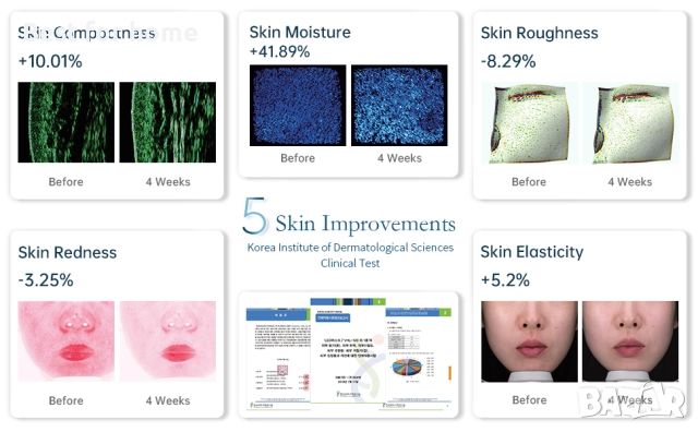 LED маска за лице GYH Cloud-S, снимка 7 - Козметични уреди - 52896464