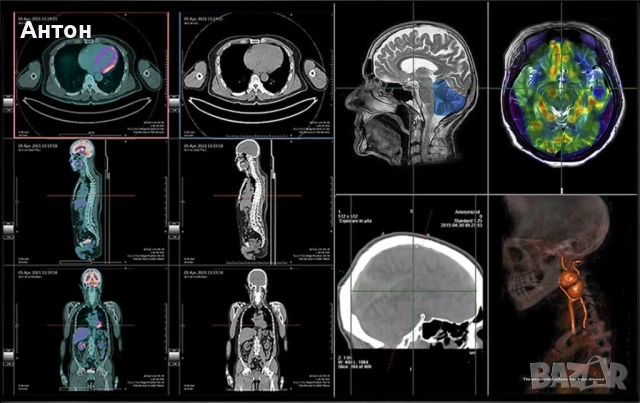 Quadro radiforce RTX 4000 EIZO MED-XN92 Medical/за медицинска диагностика