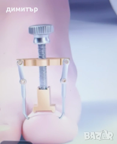 Фиксиращ инструмент и подложки за враснал нокът., снимка 3 - Други - 53569316