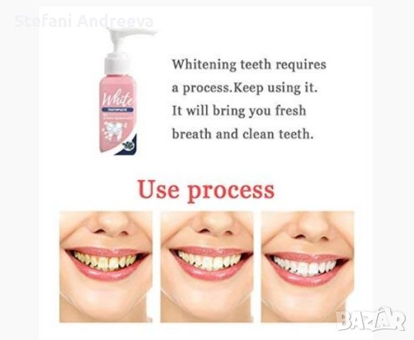 Избелваща паста за зъби , снимка 3 - Други услуги - 46082342