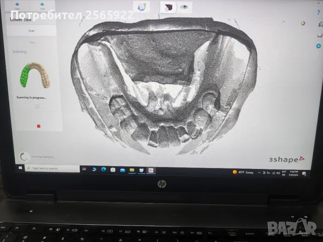 зъботехнически 3д скенер 3shape d700 , снимка 4 - Стоматология - 47086217