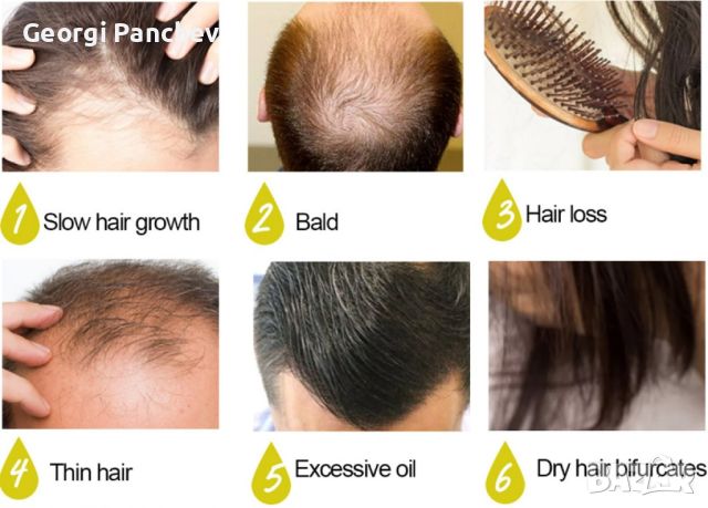 Многофункционален продукт за коса – растеж, заздравяване и сгъстяване, снимка 2 - Продукти за коса - 45919588