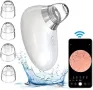 Нов смарт Вакуум уред отстраняване на черни точки пори с камера за лице, снимка 1