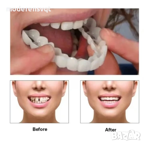 Изкуствени зъби WhiteSmile
