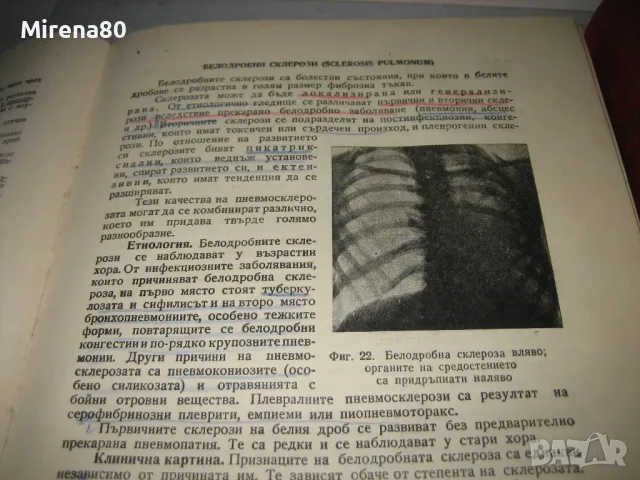 Вътрешни болести - 1959 г. - том 1 и 2, снимка 8 - Специализирана литература - 48840380