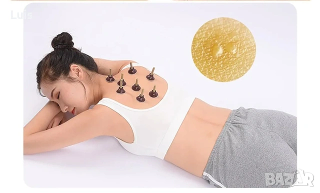 Мокса терапия по акупунктурни точки