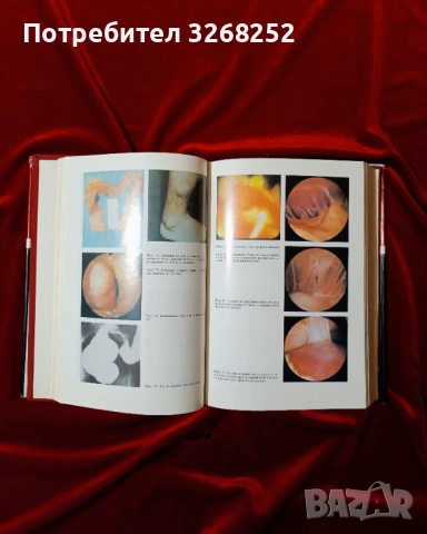 Учебник по Гастроентерология , снимка 2 - Учебници, учебни тетрадки - 53969956