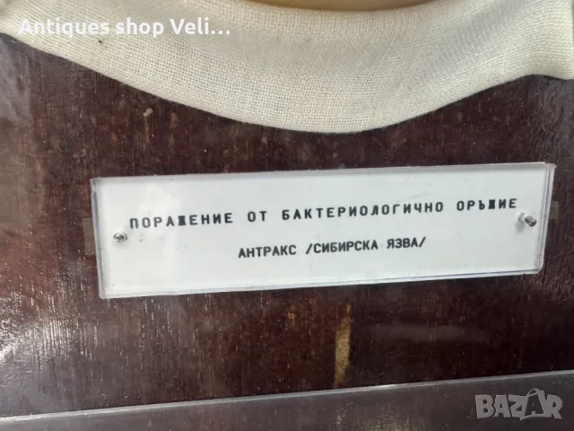 УНИКАЛНО Восъчни Ръчно Изработени Анатомични Мулажи КОЛЕКЦИЯ №69340 , снимка 4 - Антикварни и старинни предмети - 50402170