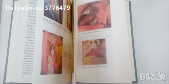 Терапевтична стоматология, снимка 2 - Специализирана литература - 44990973