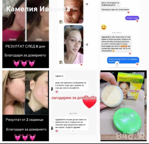 Силно избелващ крем Анти-Акне , снимка 6 - Козметика за лице - 52806065