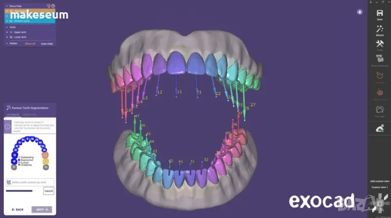 Exocad 3.2 Elefsina / Exoplan / PartialCAD, снимка 1