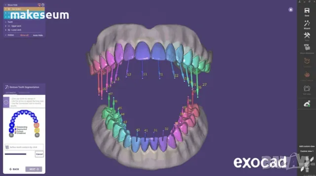 Exocad 3.2 Elefsina / Exoplan / PartialCAD, снимка 1 - IT/Компютърни - 49521395