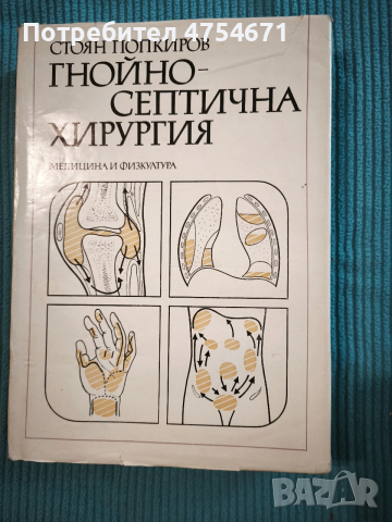 Гнойно - септична хирургия 