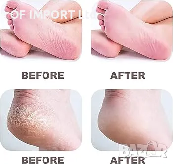 НОВО Електрическа Пила за Пети и Крака VITAL Maxx, снимка 7 - Електрически пили за пети - 49660199