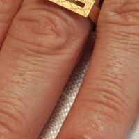 Уникален пръстен от медицинска стомана, снимка 8 - Пръстени - 45661032
