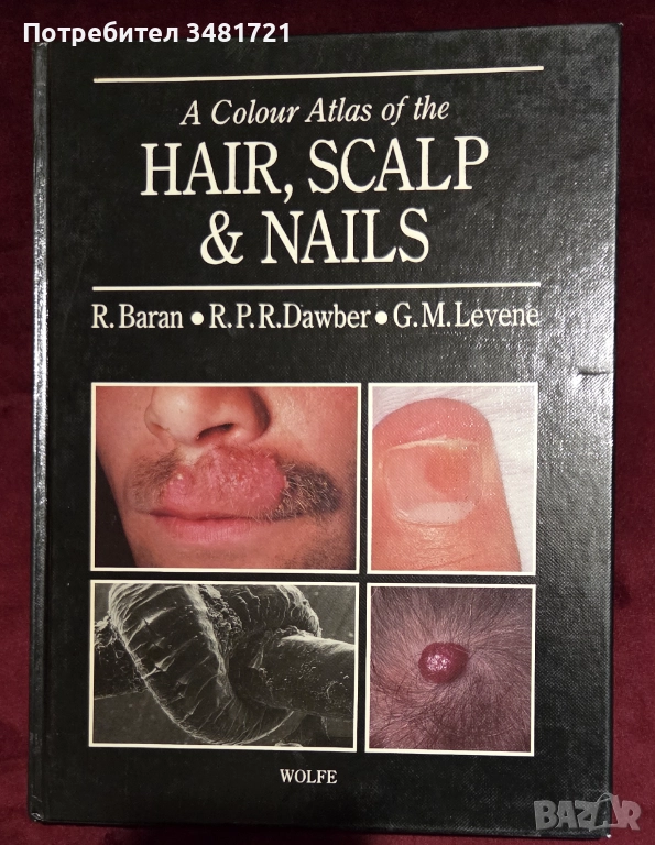 A Colour Atlas of the Hair, Scalp and Nails, снимка 1