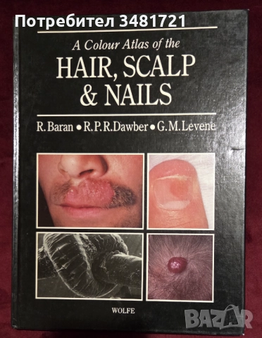 A Colour Atlas of the Hair, Scalp and Nails