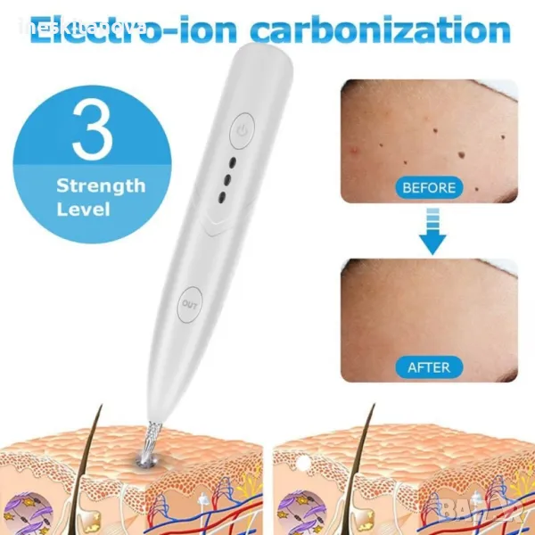 Лезерен уред Премахва бенки, петна, татуировки, брадавици, лунички;, снимка 1