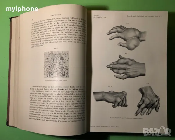 Стара Книга Болести на Обмяната Болести на Жлезите с Вътрешна секреция, снимка 3 - Специализирана литература - 49204935