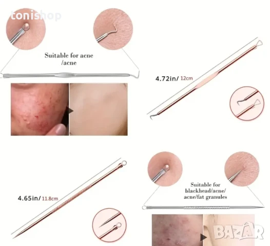 Премахване на черни точки и акне