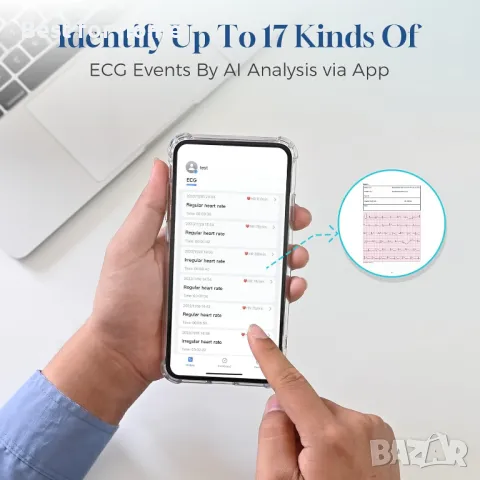 Мобилен ЕКГ апарат за дома  с OLED екран CheckMe, снимка 5 - Уреди за диагностика - 50176009
