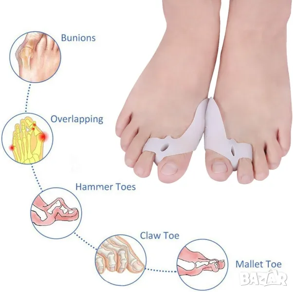 Комплект коректори за пръстите на краката Hallux Bunion Corrector, снимка 1