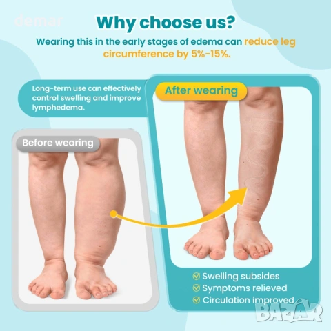 Компресионна лента Sylong® за подуване и оток на прасеца с регулируем ръкав (L), снимка 5 - Други - 53425323