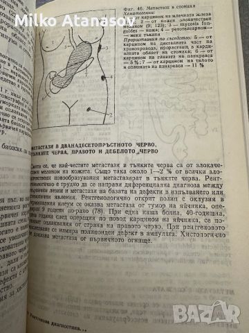 Рентгенова диагностика на метастазите-Георги Наумов,1988, стр.205, снимка 9 - Специализирана литература - 45248754