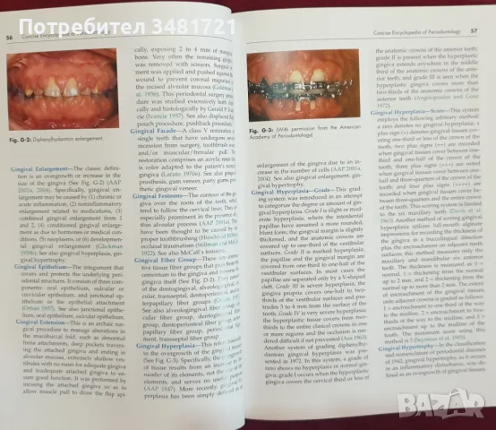 Енциклопедия на пародонтологията / Concise Encyclopedia of Periodontology, снимка 3 - Специализирана литература - 47018253