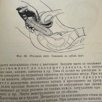 Гинекология-Илия Щъркалев,1964,стр.115, снимка 8 - Специализирана литература - 45385027