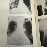 Вътрешни болести под ред.Ат.Малеев,учебник за фелдшери,1980,стр.690, снимка 16 - Специализирана литература - 45315869